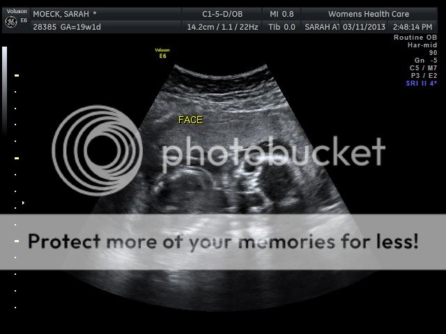 photo BABYMOECK_10_zpse09ba85f.jpg